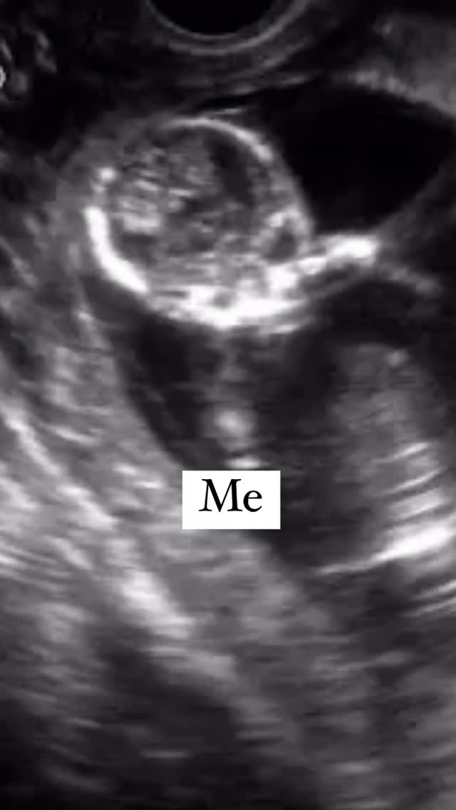 My life and yours all began at the moment of conception. Not a moment sooner, and not a moment too late. We are all willed, wanted, and loved by God.
P.s. So is every other life regardless of whether or not they were planned.